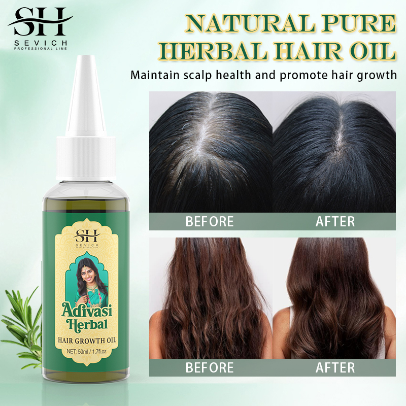 เซรั่มการเจริญเติบโตของเส้นผมน - Coconut Oil Refined บทวิจารณ์และราคา